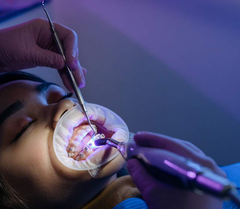 Best Dental Clinic near chitlapakkam (1) Best Dental Clinic near chitlapakkam