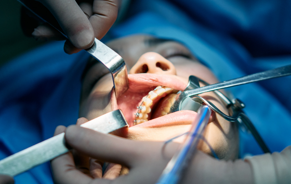 Cosmetic dentistry (1)