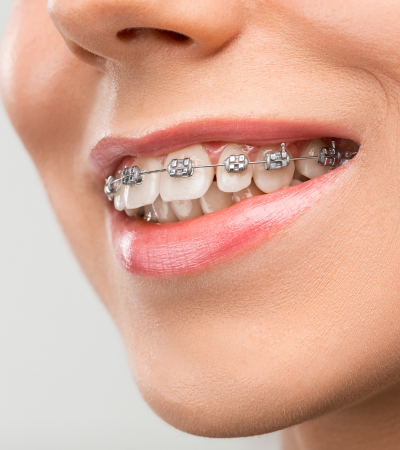 Olive Dentistry (27)