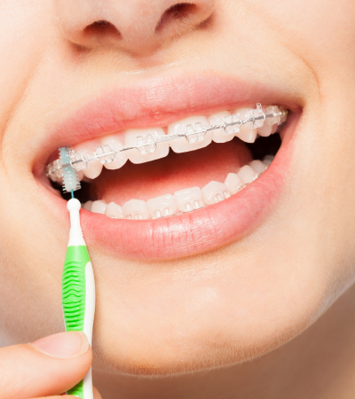 Olive Dentistry (28)