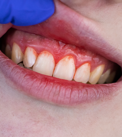 Olive Dentistry (34)