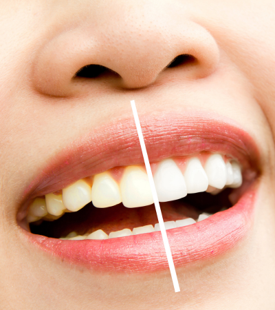 Olive Dentistry (4)