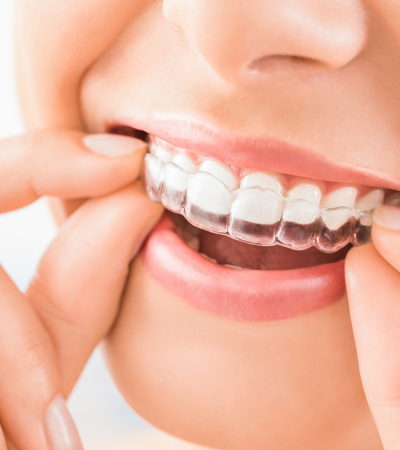 Olive Dentistry (5)