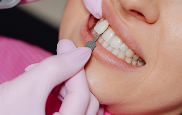 Tooth Replacement